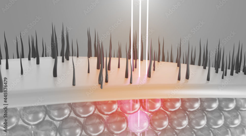 Why is 550-1200nm the Optimal Wavelength for Hair Removal?