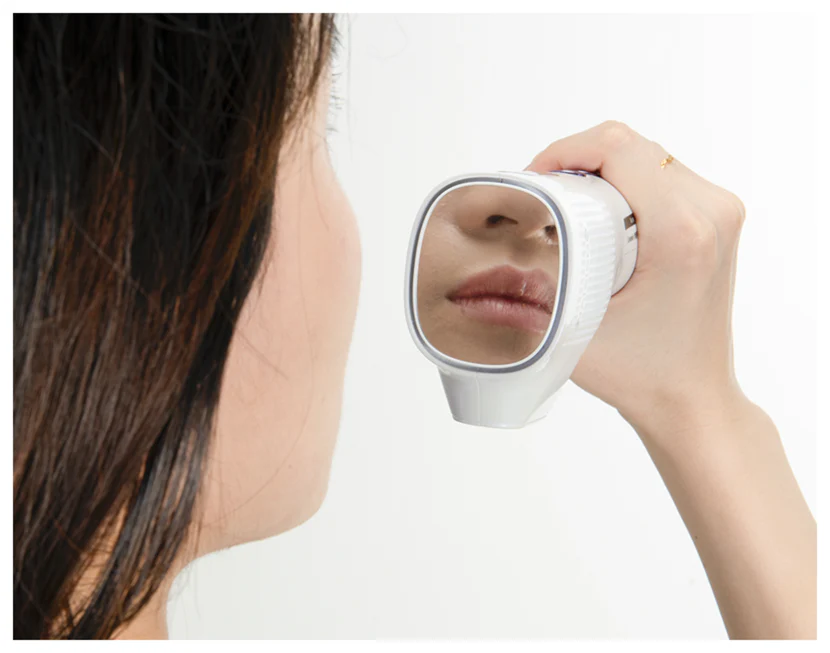 Causes and Solutions for Blackheads Around the Lips